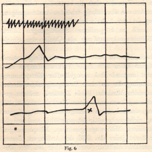 A line graph showing muscle contractions during a series of simple bow strokes executed with a relaxed shoulder