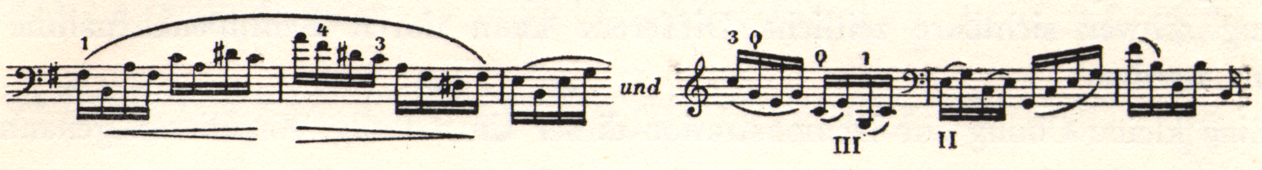 Two sections of musical notation, with "und" written between them