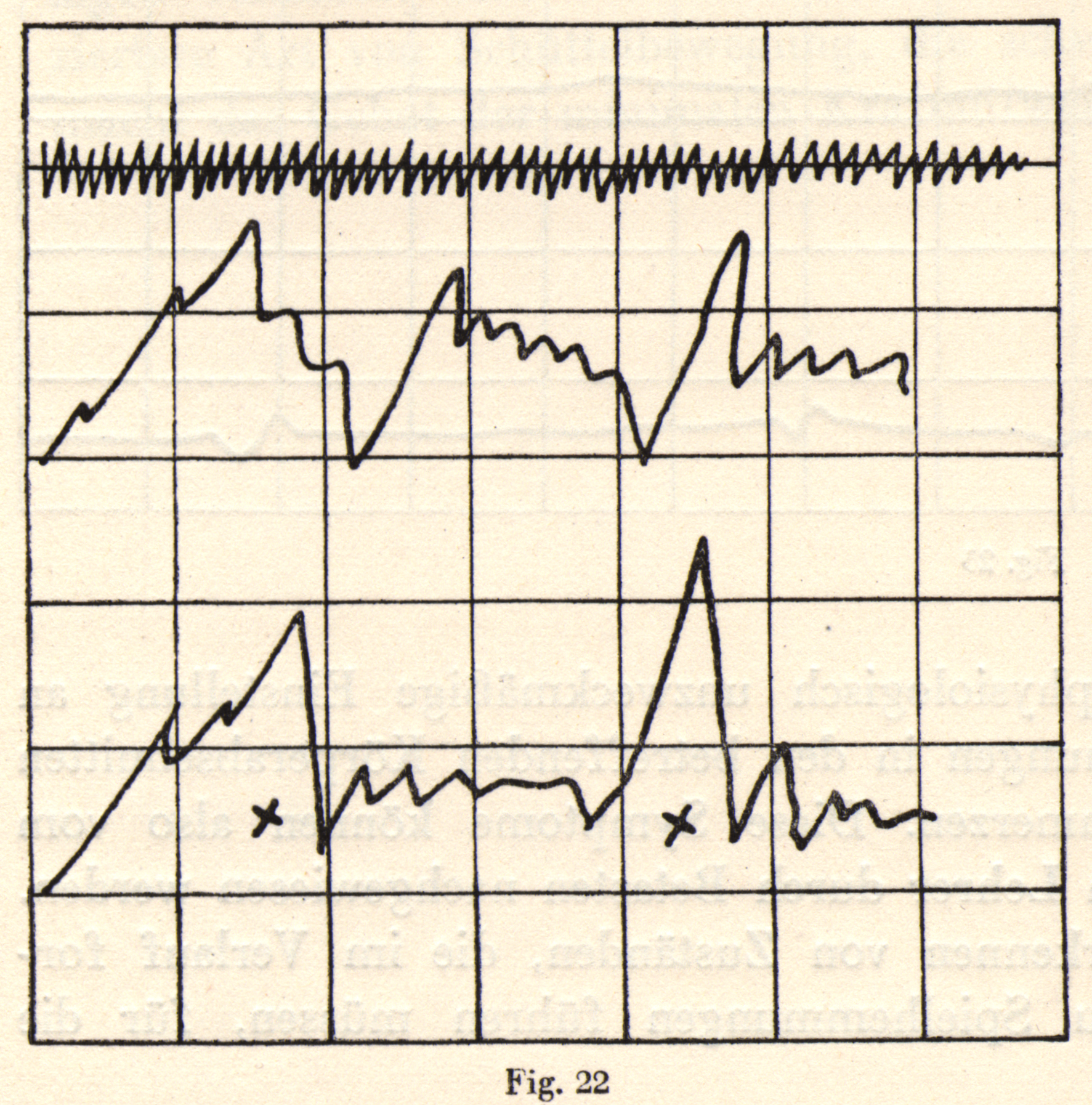 A line graph showing tension of latissimus dorsi and pectoralis major muscles