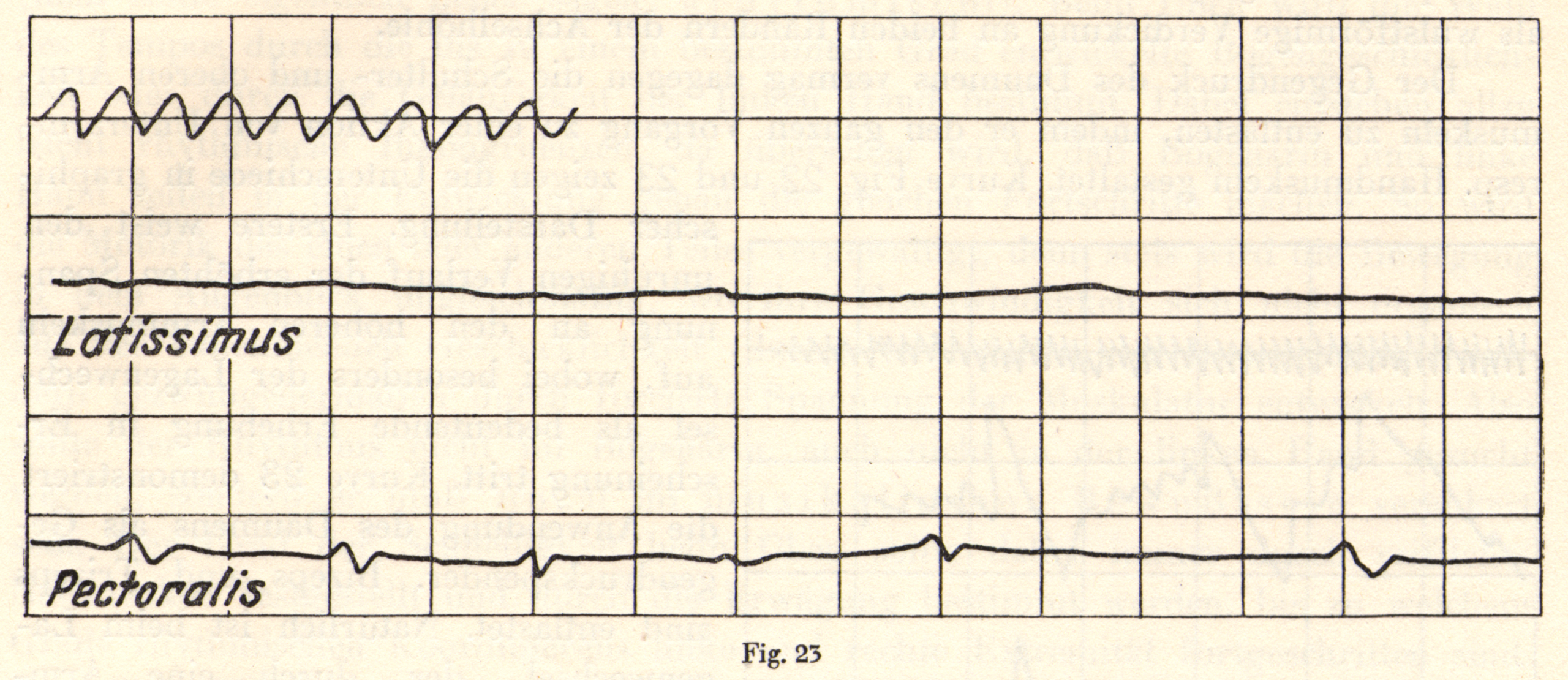 A line graph showing tension of latissimus dorsi and pectoralis major muscles